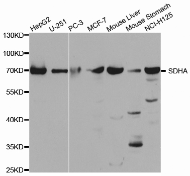 SDHA Antibody - Western blot analysis of extracts of various cell lines, using SDHA antibody.