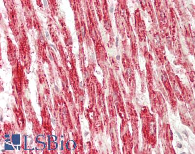 SDHA Antibody - Human Heart: Formalin-Fixed, Paraffin-Embedded (FFPE)