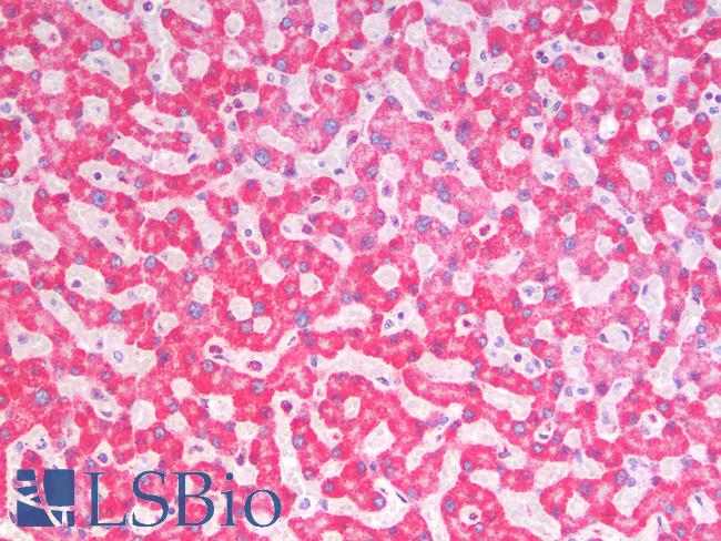 SDHA Antibody - Human Liver: Formalin-Fixed, Paraffin-Embedded (FFPE)