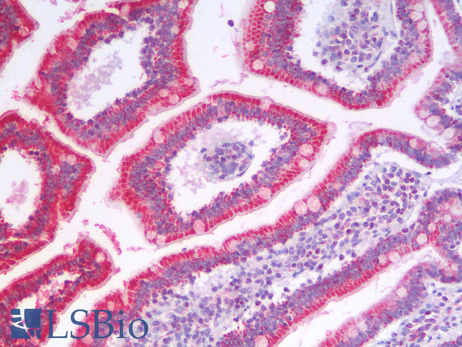 SDHA Antibody - Human Small Intestine: Formalin-Fixed, Paraffin-Embedded (FFPE)