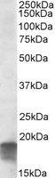 SDHAF1 Antibody - SDHAF1 antibody (0.3 ug/ml) staining of Human Cerebellum lysate (35 ug protein/ml in RIPA buffer). Primary incubation was 1 hour. Detected by chemiluminescence.