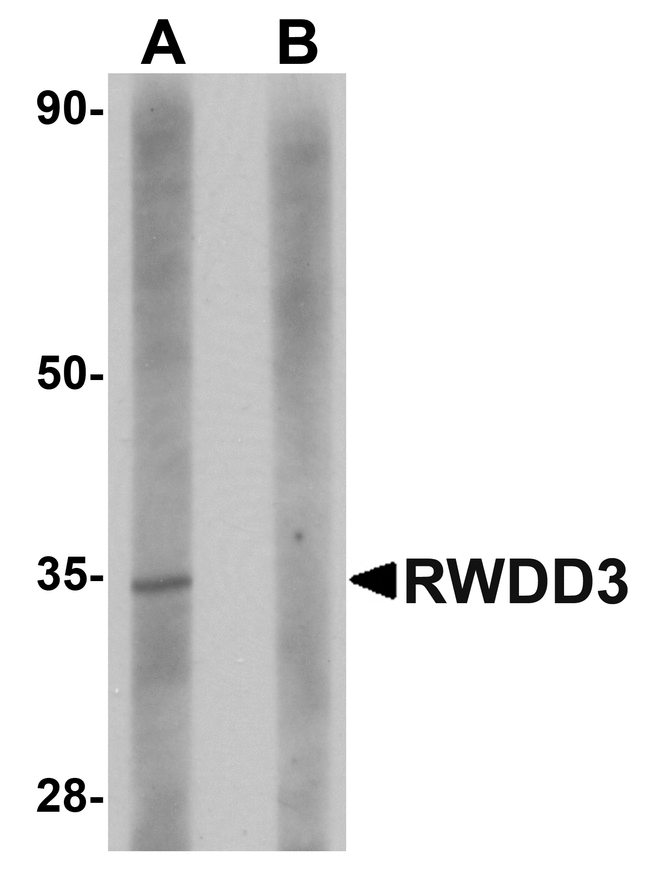 SDHAF2 Antibody - Western blot analysis of SDHAF2 in rat liver tissue lysate with SDHAF2 antibody at 1 ug/mL in (A) the absence and (B) the presence of blocking peptide.