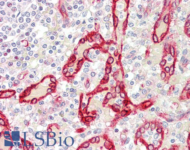 SDR / SDPR Antibody - Anti-SDR / SDPR antibody IHC staining of human spleen. Immunohistochemistry of formalin-fixed, paraffin-embedded tissue after heat-induced antigen retrieval. Antibody concentration 5 ug/ml.