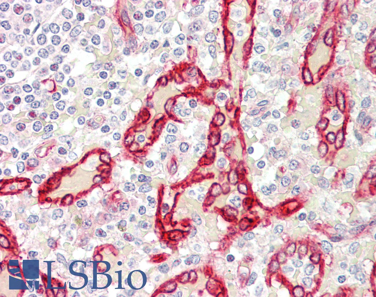 SDR / SDPR Antibody - Anti-SDR / SDPR antibody IHC staining of human spleen. Immunohistochemistry of formalin-fixed, paraffin-embedded tissue after heat-induced antigen retrieval. Antibody concentration 5 ug/ml.