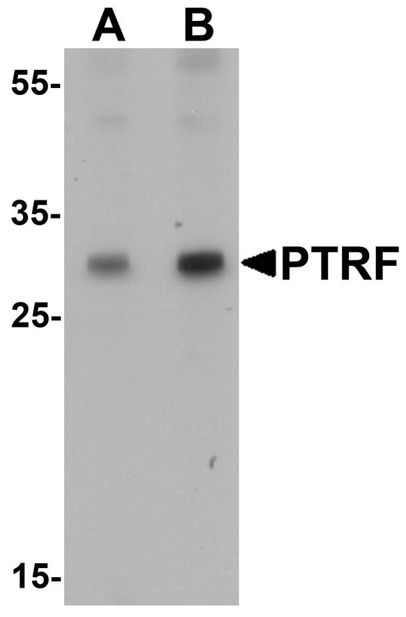 SDR / SDPR Antibody - Western blot analysis of SDPR in HeLa cell lysate with SDPR antibody at (A) 1 and (B) 2 ug/ml