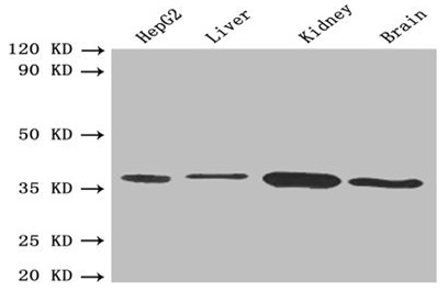 SDR9C1 / BDH1 Antibody - Western blot All lanes: BDH1 antibody at 2.4µg/ml Lane 1: HepG2 whole cell lysate Lane 2: Mouse liver tissue Lane 3: Mouse kidney tissue Lane 4: Mouse brain tissue Secondary Goat polyclonal to rabbit IgG at 1/10000 dilution Predicted band size: 39 kDa Observed band size: 39 kDa