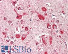 SEC13 Antibody - Human Brain, Cortex: Formalin-Fixed, Paraffin-Embedded (FFPE)