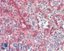 SEC23A / COP II Antibody - Human Spleen: Formalin-Fixed, Paraffin-Embedded (FFPE)