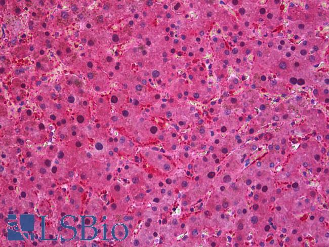 SEC61A1 / SEC61 Antibody - Anti-SEC61A1 / SEC61 antibody IHC of human liver. Immunohistochemistry of formalin-fixed, paraffin-embedded tissue after heat-induced antigen retrieval. Antibody concentration 3.75 ug/ml.