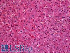 SEC61A1 / SEC61 Antibody - Anti-SEC61A1 / SEC61 antibody IHC of human liver. Immunohistochemistry of formalin-fixed, paraffin-embedded tissue after heat-induced antigen retrieval. Antibody concentration 3.75 ug/ml.