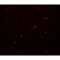 SEC62 / TP-1 Antibody - Immunofluorescence of SEC62 in mouse brain tissue with SEC62 antibody at 20 µg/mL.