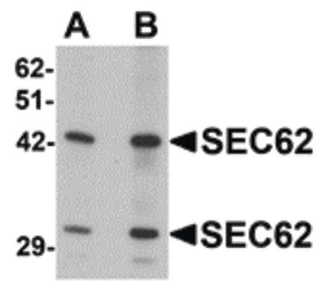 SEC62 / TP-1 Antibody - Western blot of SEC62 in rat brain tissue lysate with SEC62 antibody at (A) 0.5 and (B) 1 ug/ml.