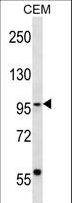 SEC63 Antibody - SEC63 Antibody western blot of CEM cell line lysates (35 ug/lane). The SEC63 antibody detected the SEC63 protein (arrow).