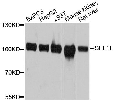 SEL1L Antibody - Western blot analysis of extracts of various cell lines, using SEL1L antibody at 1:3000 dilution. The secondary antibody used was an HRP Goat Anti-Rabbit IgG (H+L) at 1:10000 dilution. Lysates were loaded 25ug per lane and 3% nonfat dry milk in TBST was used for blocking. An ECL Kit was used for detection and the exposure time was 20s.