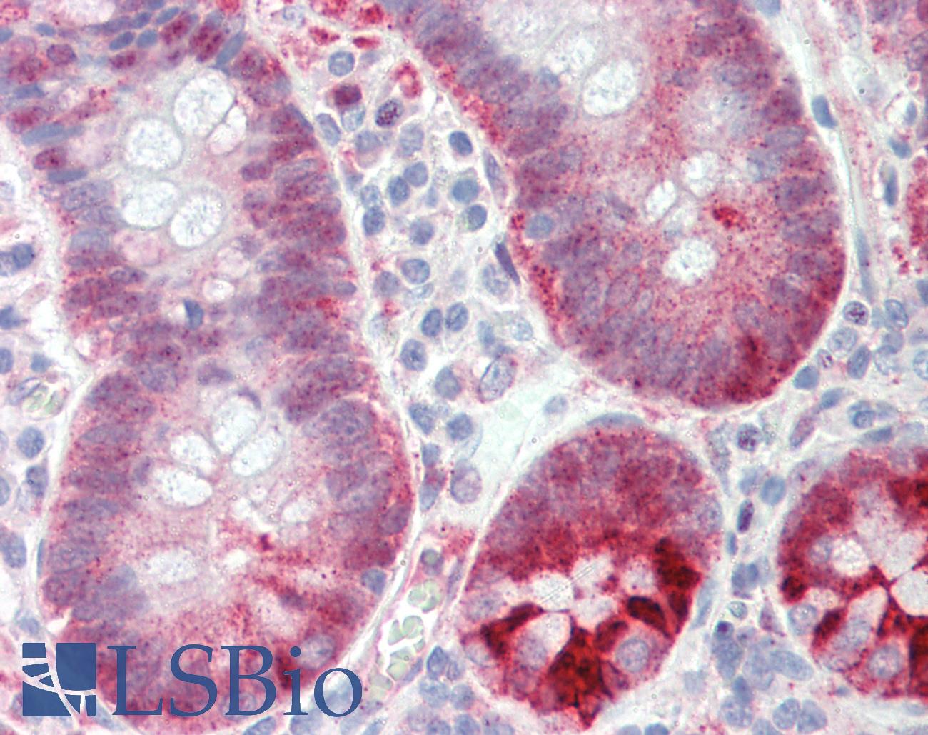 Selenium Binding Protein 1 Antibody - Anti-SELENBP1 / SP56 antibody IHC staining of human small intestine. Immunohistochemistry of formalin-fixed, paraffin-embedded tissue after heat-induced antigen retrieval.