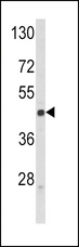 SELL / L-Selectin / CD62L Antibody - Western blot of SELL Antibody in Jurkat cell line lysates (35 ug/lane). SELL (arrow) was detected using the purified antibody.