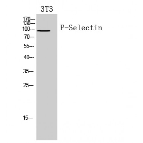 SELP / P-Selectin / CD62P Antibody - Western blot of P-Selectin antibody