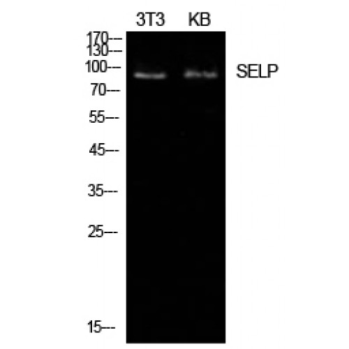 SELP / P-Selectin / CD62P Antibody - Western blot of P-Selectin antibody