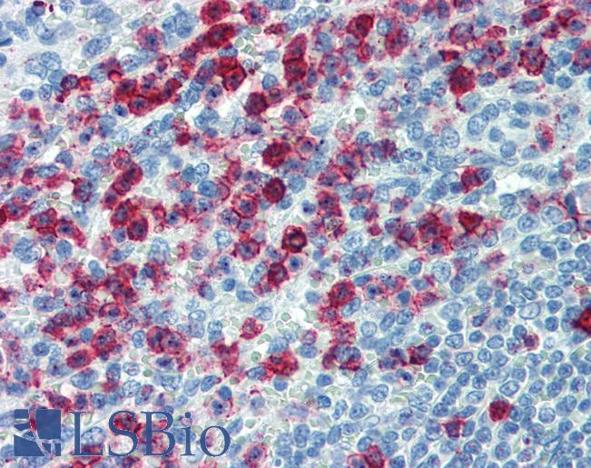 SELPLG / PSGL-1 / CD162 Antibody - Anti-SELPLG / CD162 antibody IHC of human spleen. Immunohistochemistry of formalin-fixed, paraffin-embedded tissue after heat-induced antigen retrieval. Antibody concentration 10 ug/ml.