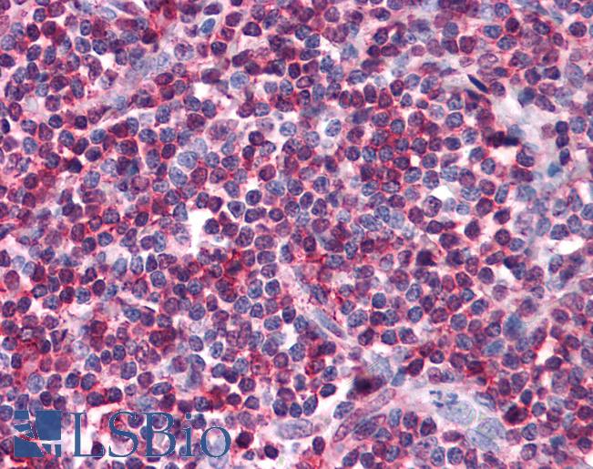 SELPLG / PSGL-1 / CD162 Antibody - Anti-SELPLG / CD162 antibody IHC of human tonsil. Immunohistochemistry of formalin-fixed, paraffin-embedded tissue after heat-induced antigen retrieval. Antibody concentration 10 ug/ml.