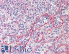 SEMA4C / Semaphorin 4C Antibody - Human Spleen: Formalin-Fixed, Paraffin-Embedded (FFPE)