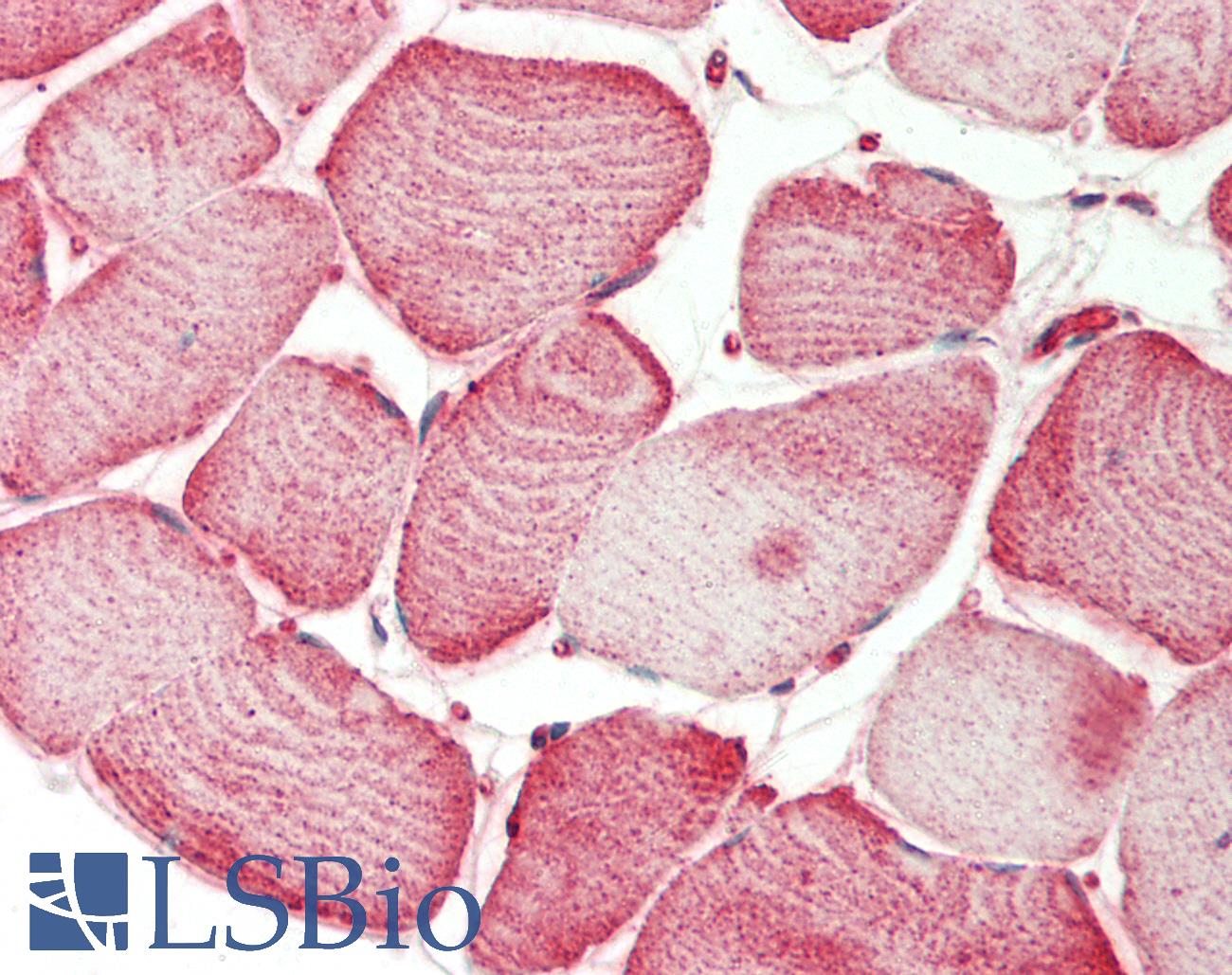 IHC-plus™ SEMA4D / Semaphorin 4D / CD100 Polyclonal Antibody | LSBio
