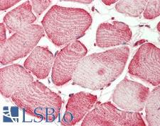 SEMA4D / Semaphorin 4D / CD100 Antibody - Human Skeletal Muscle: Formalin-Fixed, Paraffin-Embedded (FFPE)