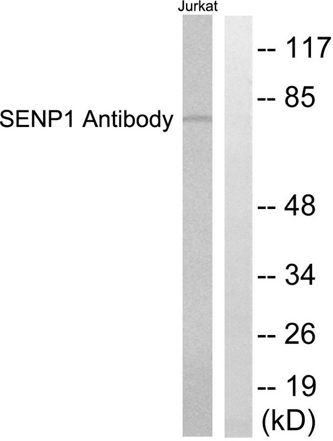 SENP1 Antibody - Western blot analysis of lysates from Jurkat cells, using SENP1 Antibody. The lane on the right is blocked with the synthesized peptide.