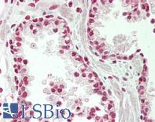 SENP3 Antibody - Human Prostate: Formalin-Fixed, Paraffin-Embedded (FFPE)