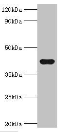 SEPP1 / Selenoprotein P Antibody - Western blot All lanes: Selenoprotein P antibody at 2µg/ml + Mouse heart tissue Secondary Goat polyclonal to rabbit IgG at 1/10000 dilution Predicted band size: 43 kDa Observed band size: 43 kDa