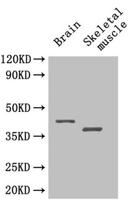SEPP1 / Selenoprotein P Antibody - Western Blot Positive WB detected in: Mouse brain tissue, Mouse skeletal muscle tissue All lanes: SEPP1 antibody at 4µg/ml Secondary Goat polyclonal to rabbit IgG at 1/50000 dilution Predicted band size: 43 kDa Observed band size: 43, 40 kDa