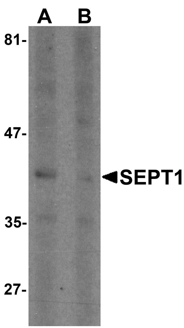 SEPT1 / Septin 1 Antibody - Western blot analysis of SEPT1 in Raji cell lysate with SEPT1 antibody at 1 ug/ml in (A) the absence and (B) the presence of blocking peptide.