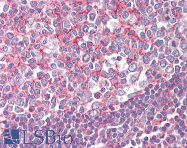 SEPT2 / Septin 2 Antibody - Anti-SEPT2 / Septin 2 antibody IHC of human tonsil. Immunohistochemistry of formalin-fixed, paraffin-embedded tissue after heat-induced antigen retrieval. Antibody concentration 2.5 ug/ml.