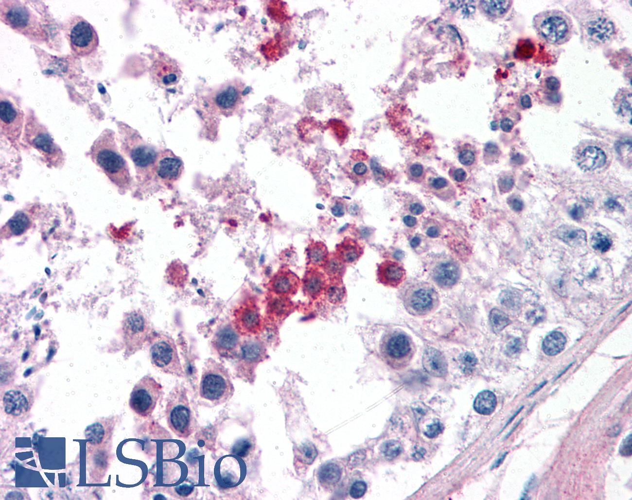 SEPT3 / Septin 3 Antibody - Anti-SEPT3 / Septin 3 antibody IHC of human testis. Immunohistochemistry of formalin-fixed, paraffin-embedded tissue after heat-induced antigen retrieval. Antibody concentration 3.75 ug/ml.