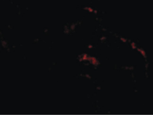 SEPT4 / Septin 4 Antibody - Immunofluorescence of ARTS in Human Lung cells with ARTS antibody at 20 ug/ml.