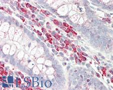 SEPT6 / Septin 6 Antibody - Human Small Intestine: Formalin-Fixed, Paraffin-Embedded (FFPE)