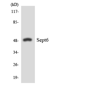 SEPT6 / Septin 6 Antibody - Western blot analysis of the lysates from HeLa cells using SEPT6 antibody.