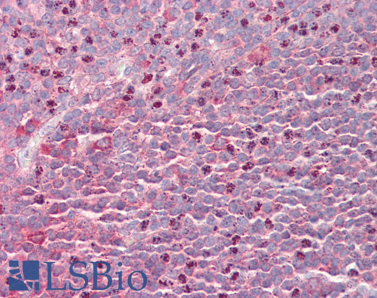 SEPT6 / Septin 6 Antibody - Anti-SEPT6 / Septin 6 antibody IHC staining of human tonsil. Immunohistochemistry of formalin-fixed, paraffin-embedded tissue after heat-induced antigen retrieval.