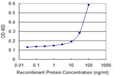 SEPT6 / Septin 6 Antibody - Detection limit for recombinant GST tagged SEPT6 is 3 ng/ml as a capture antibody.