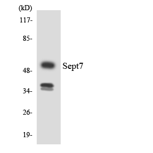 SEPT7 / Septin 7 Antibody - Western blot analysis of the lysates from HUVECcells using SEPT7 antibody.