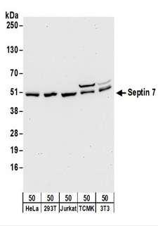 SEPT7 / Septin 7 Antibody - Detection of Human and Mouse Septin 7 by Western Blot. Samples: Whole cell lysate (50 ug) from HeLa, 293T, Jurkat, mouse TCMK-1, and mouse NIH3T3 cells. Antibodies: Affinity purified rabbit anti-Septin 7 antibody used for WB at 0.1 ug/ml. Detection: Chemiluminescence with an exposure time of 30 seconds.