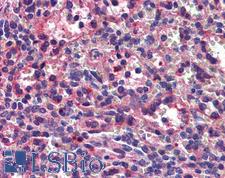 SEPT8 / Septin 8 Antibody - Anti-SEPT8 / Septin 8 antibody IHC of human spleen. Immunohistochemistry of formalin-fixed, paraffin-embedded tissue after heat-induced antigen retrieval. Antibody concentration 3 ug/ml.