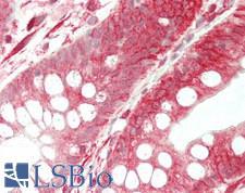 SEPT9 / Septin 9 Antibody - Human Colon: Formalin-Fixed, Paraffin-Embedded (FFPE)