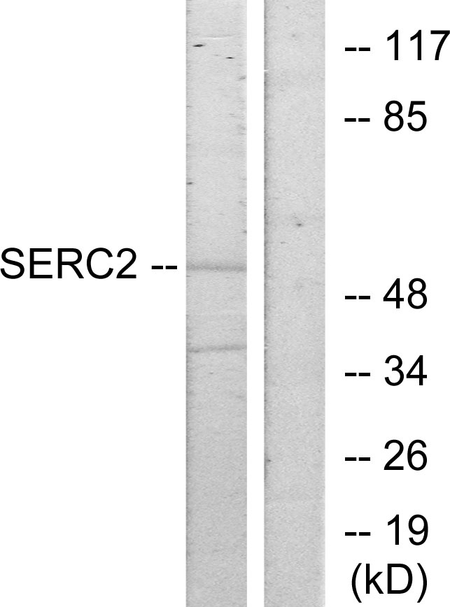 SERINC2 Antibody - Western blot analysis of lysates from HeLa cells, using SERC2 Antibody. The lane on the right is blocked with the synthesized peptide.