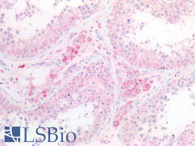 SERP1 Antibody - Human Testis: Formalin-Fixed, Paraffin-Embedded (FFPE)