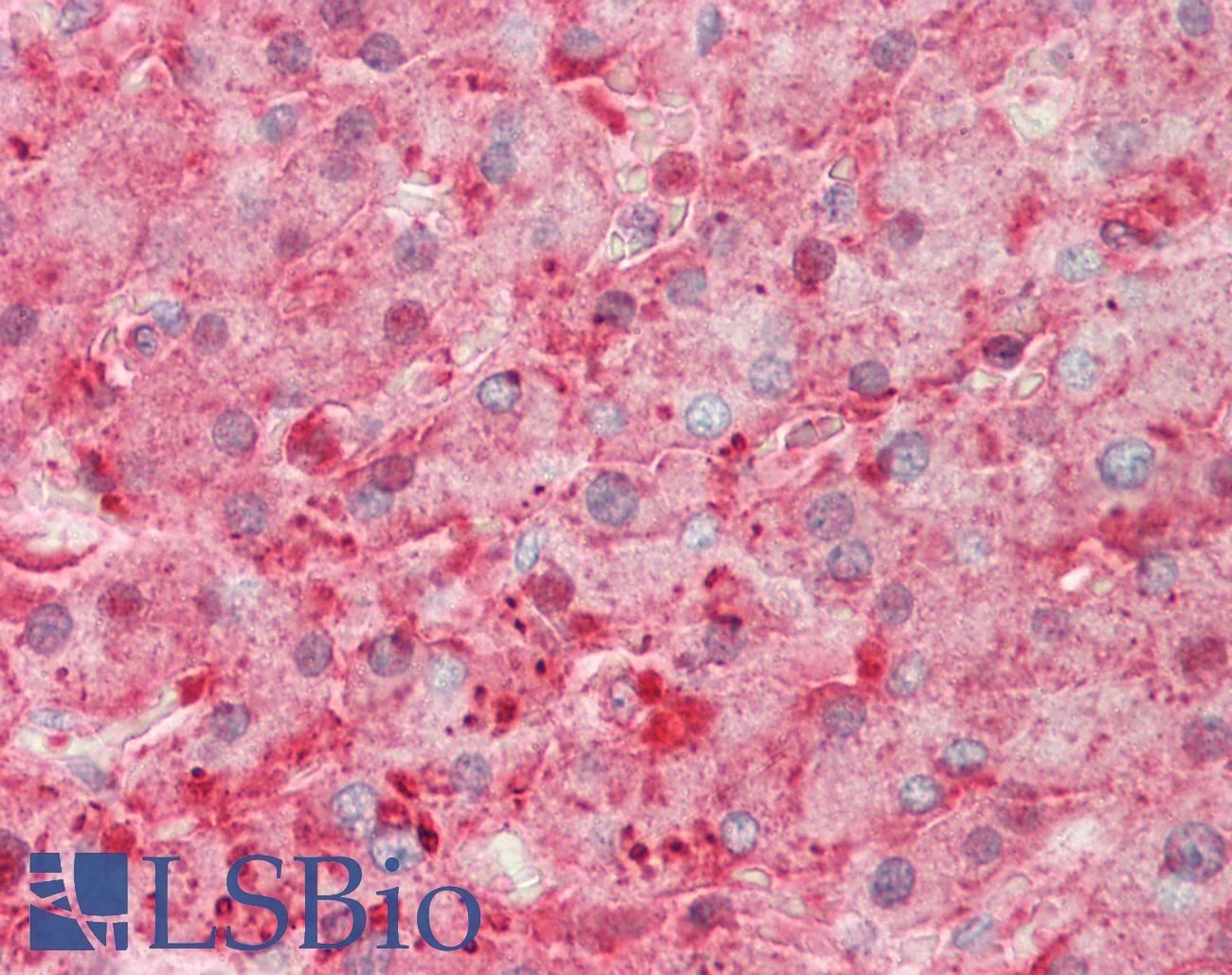 SERPINA1 / Alpha 1 Antitrypsin Antibody - Human Liver: Formalin-Fixed, Paraffin-Embedded (FFPE)