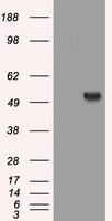 SERPINA1 / Alpha 1 Antitrypsin Antibody - HEK293T cells were transfected with the pCMV6-ENTRY control (Left lane) or pCMV6-ENTRY SERPINA1 (Right lane) cDNA for 48 hrs and lysed. Equivalent amounts of cell lysates (5 ug per lane) were separated by SDS-PAGE and immunoblotted with anti-SERPINA1.