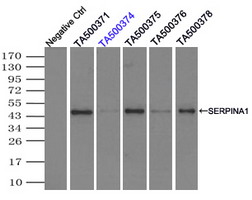 SERPINA1 / Alpha 1 Antitrypsin Antibody - Immunoprecipitation(IP) of SERPINA1 by using TrueMab monoclonal anti-SERPINA1 antibodies (Negative control: IP without adding anti-SERPINA1 antibody.). For each experiment, 500ul of DDK tagged SERPINA1 overexpression lysates (at 1:5 dilution with HEK293T lysate), 2ug of anti-SERPINA1 antibody and 20ul (0.1mg) of goat anti-mouse conjugated magnetic beads were mixed and incubated overnight. After extensive wash to remove any non-specific binding, the immuno-precipitated products were analyzed with rabbit anti-DDK polyclonal antibody.