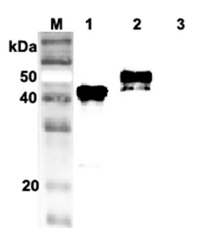 SERPINA12 / Vaspin Antibody - Western blot analysis using anti-Vaspin (human), mAb (VP63) at 1:1000 dilution. 1: Human vaspin (His-tagged). 2: Human vaspin (FLAG-tagged) (negative control).