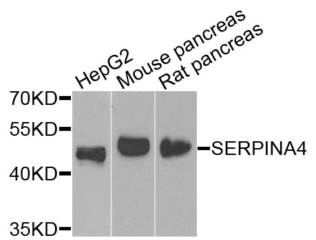 SERPINA4 / Kallistatin Antibody - Western blot blot of extracts of various cells, using SERPINA4 antibody.